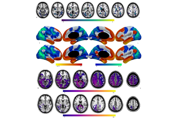 visuospatial